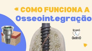 Osseointegração Resumos De Odonto