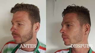 Corte Para Hombre Con Maquina Y Tijera Paso A Paso Leonardo Ramirez