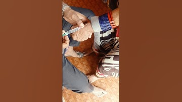 नस में इंजेक्शन लगाने का सही तरीका | injection lagaye |Drx Ranjeet helth care #shorts #doctor #neet