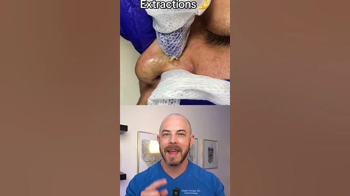 Derm reacts to super satisfying nose pimple pops! #dermreacts #dictorreacts #pimplepop