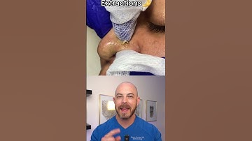 Derm reacts to super satisfying nose pimple pops! #dermreacts #dictorreacts #pimplepop