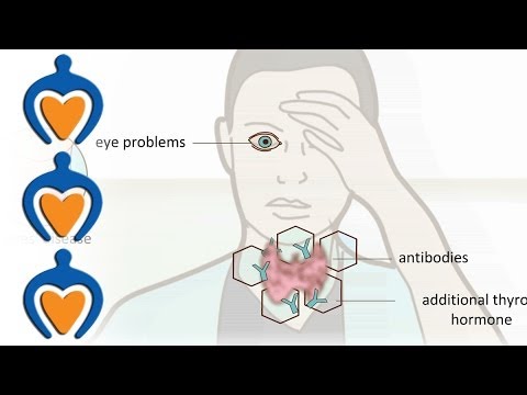 Video: Euthyreoïdie Van De Schildklier - Wat Is Het? Symptomen En Behandeling