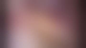 【#14】Uniportal VATS Lt.  S4a segmentectomy for metastatic lung tumor (転移性肺腫瘍に対する単孔式胸腔鏡下左S4a区域切除術)