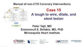 Case 15: PCI Manual - Balloon undilatable