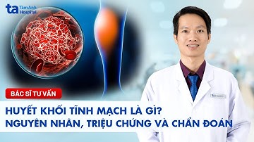 Huyết khối tĩnh mạch là gì? Nguyên nhân, triệu chứng và chẩn đoán | BS.CKI Bùi Trọng Đạt
