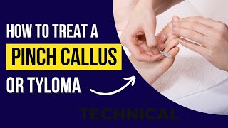 How To Treat A Pinch Callus Or Tyloma? How To Stop A Pinch Callus From Reforming?