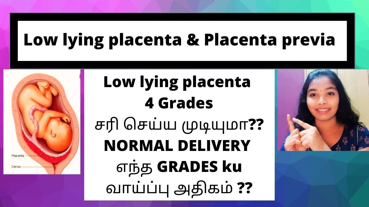 Low lying placenta&Placenta previaHow to Treat it NaturallyIs it