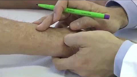 Come curare la tenosinovite alla spalla?