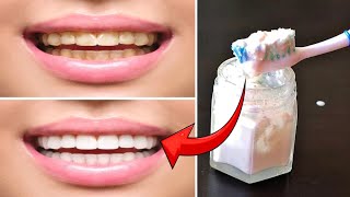 From Yellow to Wow: Transformative Teeth Whitening Tips | How teeth whitening work