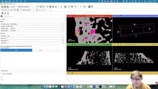 Slicer Bone Imaging Toolbox: Mechanoregulation Analysis