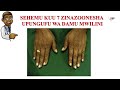 Chanzo Cha Upungufu Wa Damu Anemia Dalili Viashilia Madhara Na Suluhisho Au Matibabu 255715047591