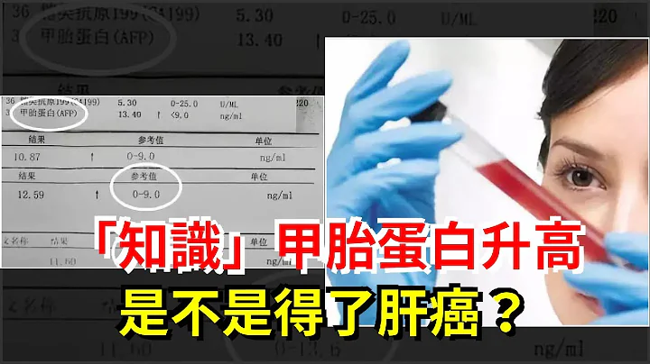 「知識」甲胎蛋白升高，是不是得了肝癌？ - 天天要聞