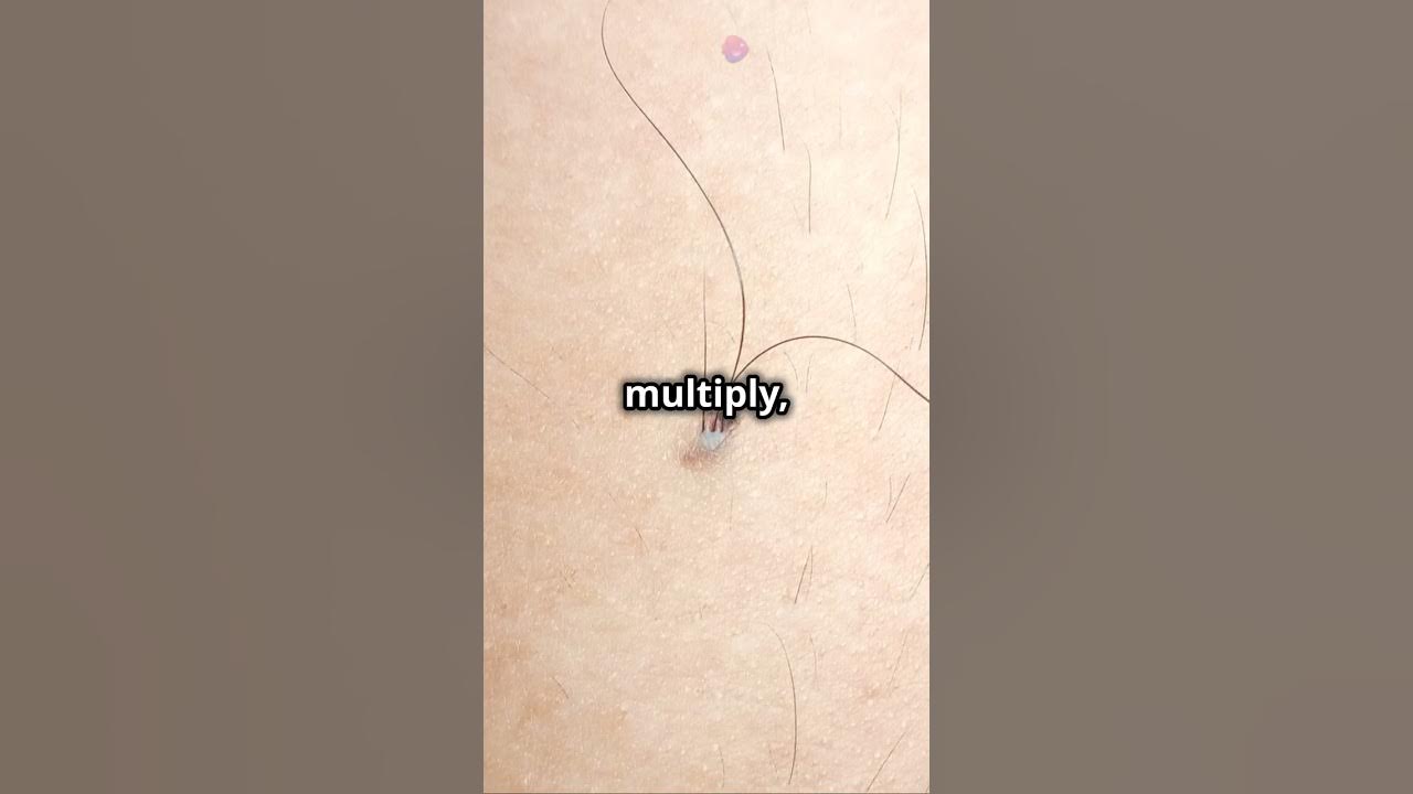 how-are-moles-formed-youtube
