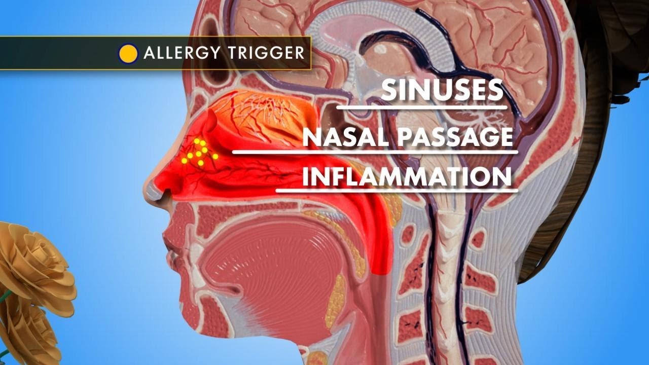 Allergy Week Beat Nasal Congestion YouTube
