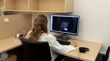 Fetal Brain MRI Segmentation and Feature Extraction