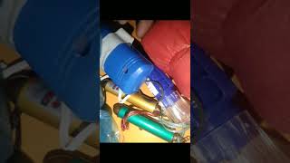 myall laser light