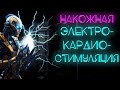 Накожная электрокардиостимуляция. Как стимуляция выполняется и что делать. #ПроСМП