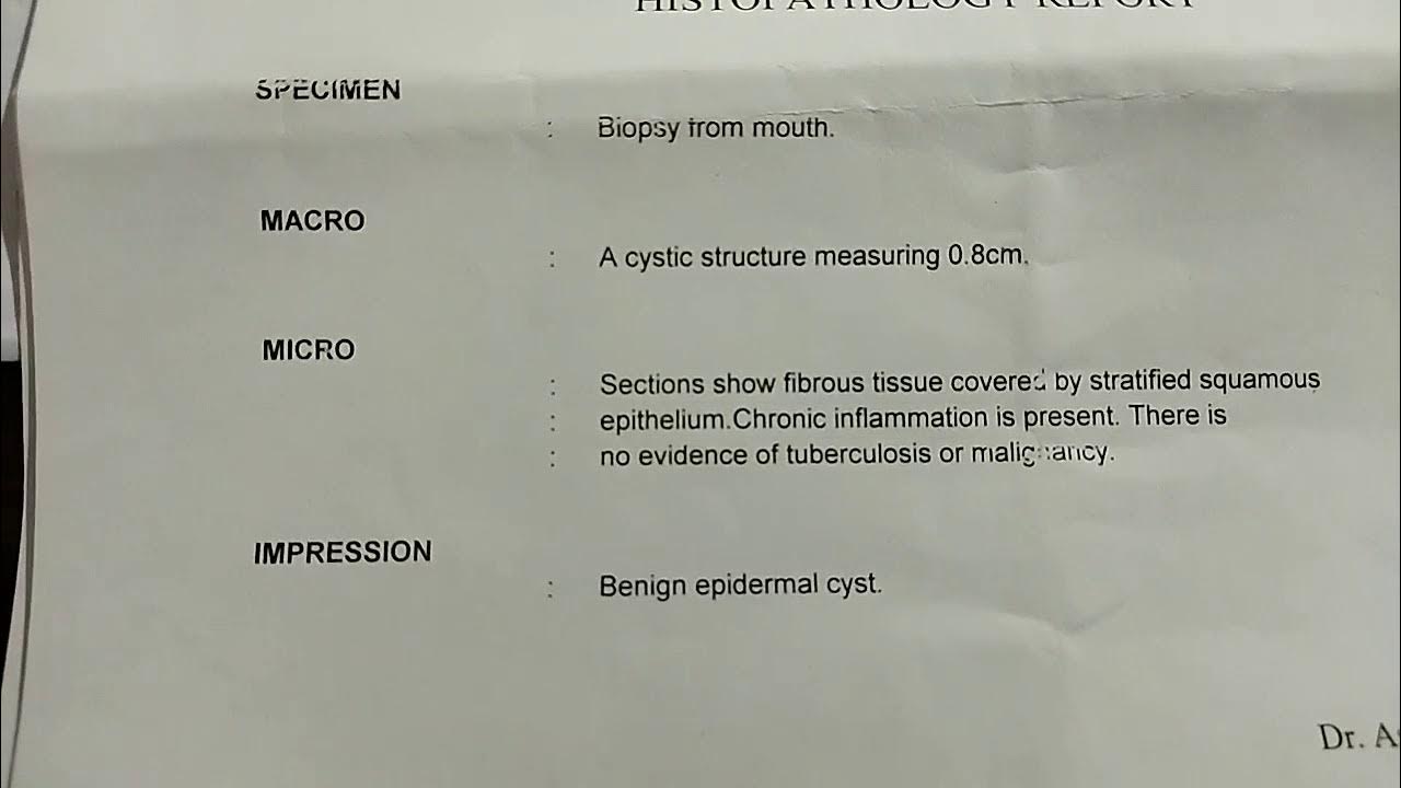 Biopsy test report in hindi // how to read Biopsy test report YouTube