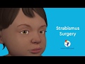 What is Strabismus Surgery?