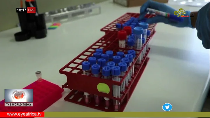 AFRICAN UNION MEMBERS CONCERNS WITH DEVELOPMENT OF COVID 19 VACCINE