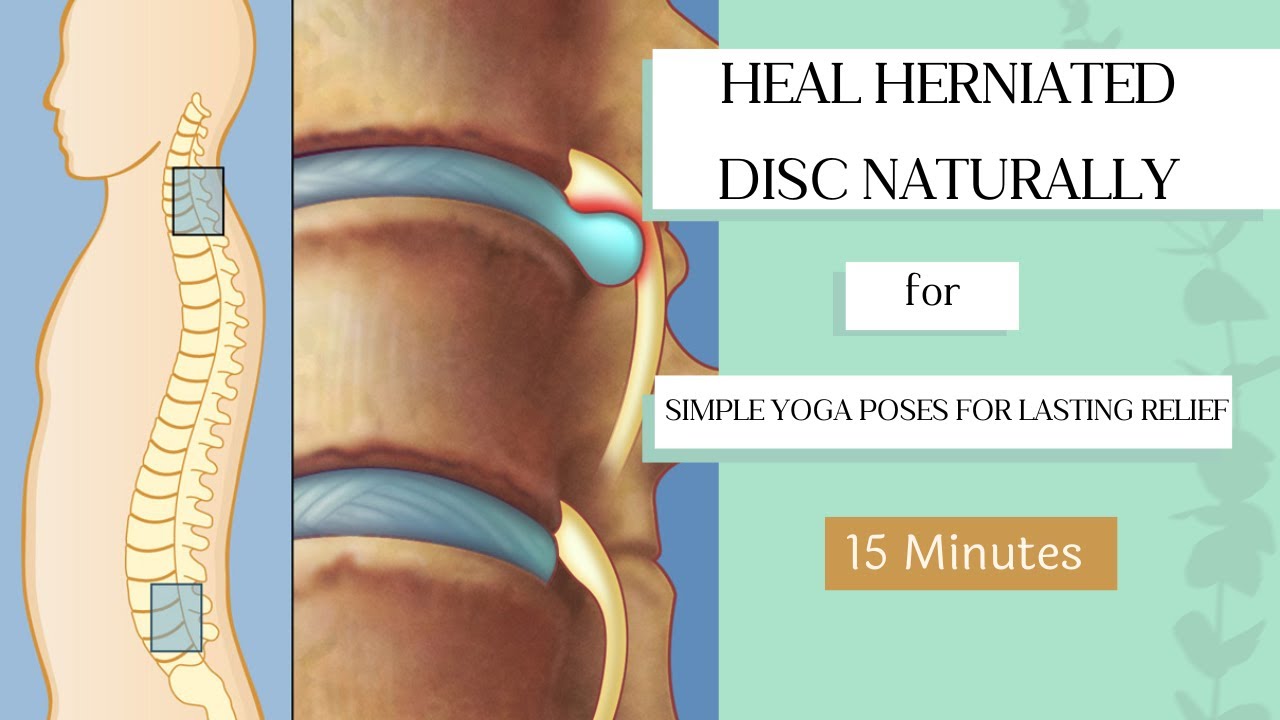 heal-herniated-disc-naturally-simple-yoga-poses-for-lasting-relief