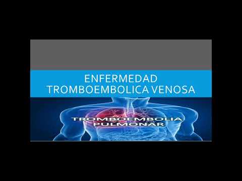 Enfermedad tronboembolica venosa