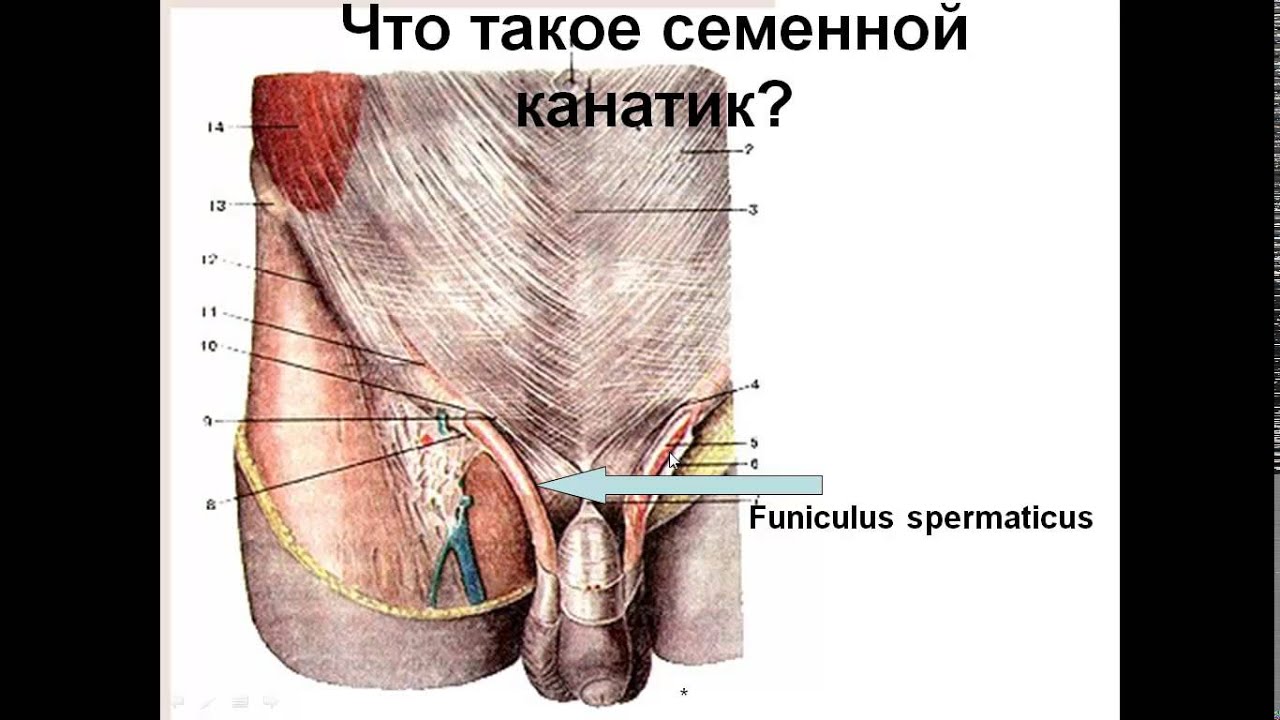 Где Находится Паховая Вена У Женщин Фото