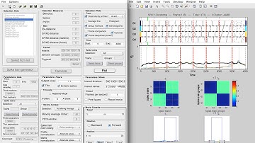 SPIKY 1 - General introduction (long version)