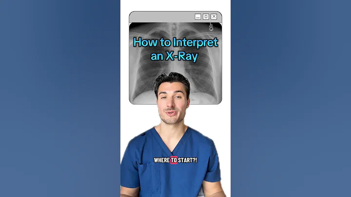 How to Interpret a Chest X-Ray 🩻#medstudent #medschool #usmle #usmlestep1 #usmlestep2 #xray