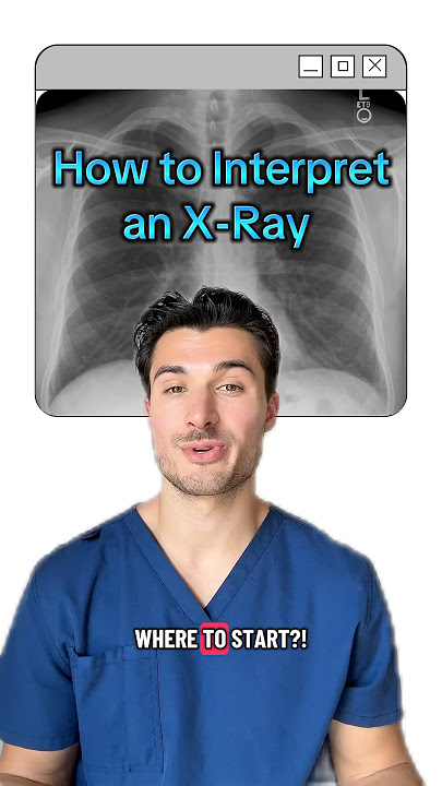 How to Interpret a Chest X-Ray 🩻#medstudent #medschool #usmle #usmlestep1 #usmlestep2 #xray