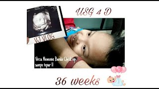USG 4D 36 WEEKS PREGNANCY CHECK UP  | VENNI DARMALIA | VJVLOG#5