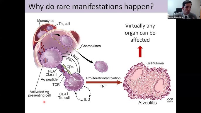 Краснодар жезөкшелері, өзгенің әйелдері
