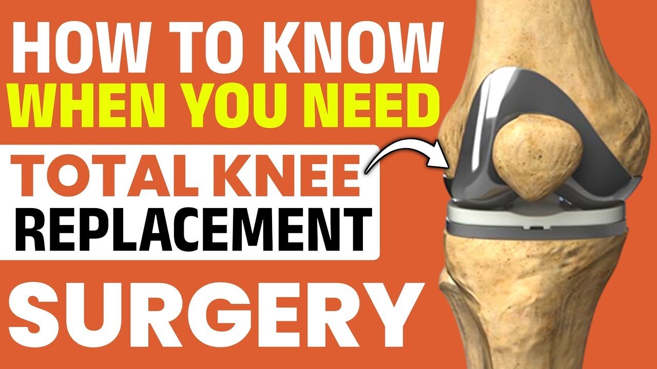 Dr.PC Live-Total Knee Replacement: How to Know It’s Time (In Hindi ...