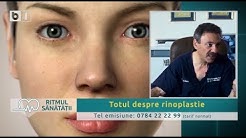 totul despre video varice