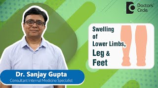 How to get rid of swelling in Legs and Feet?#health#expertskisuno-Dr. Sanjay Gupta|Doctors' Circle