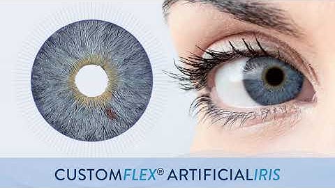 Informationsvideo CUSTOMFLEX® ARTIFICIALIRIS