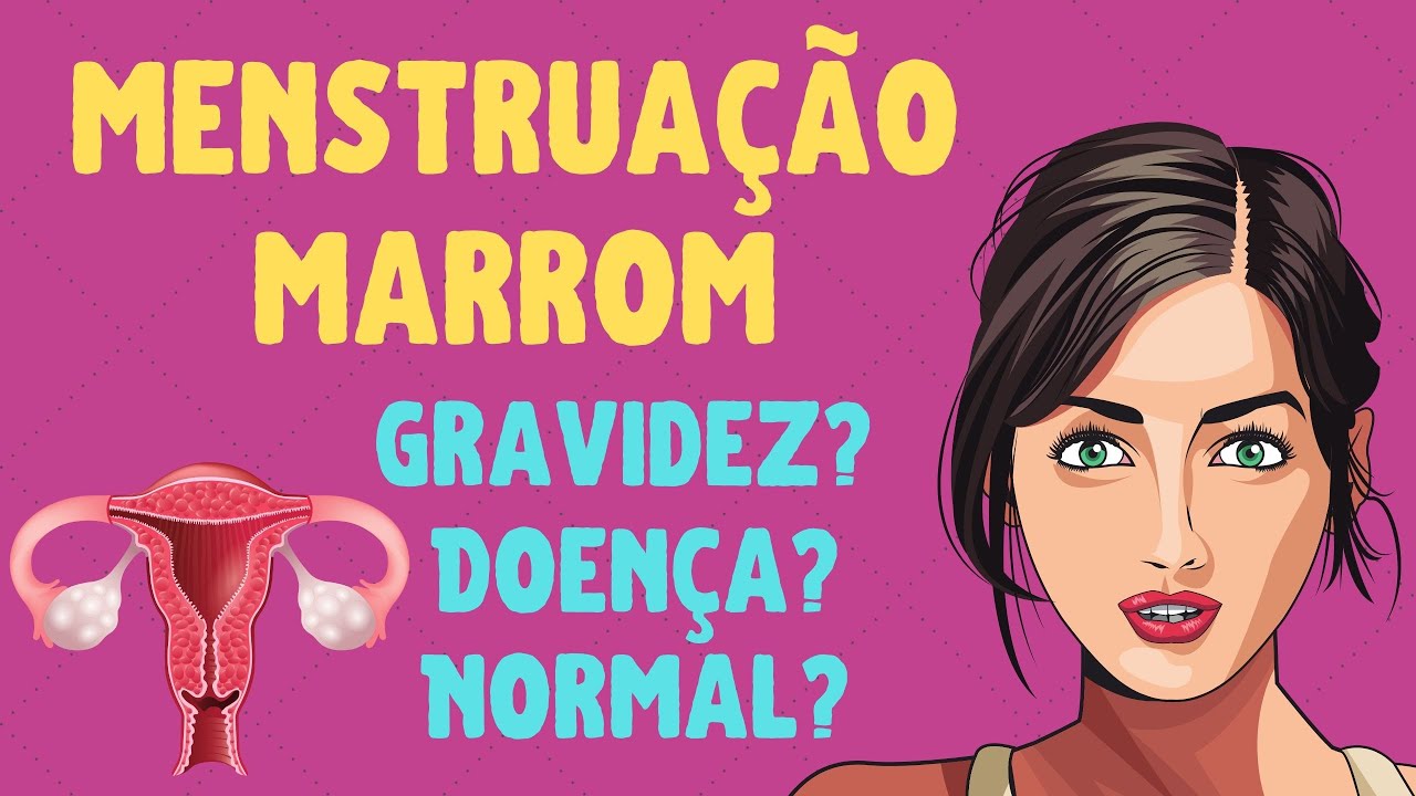 Artigo: Menstruação escura pode ser sinal de gravidez, diz médico. Saiba  quando acontece! - SGORJ