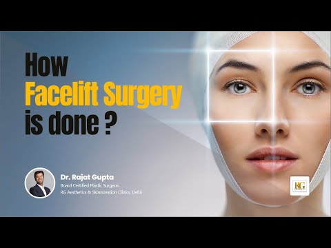 Facelift Surgery Guide  The American Board of Cosmetic Surgery