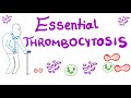 Essential Thrombocytosis (ET) | Myeloproliferative Neoplasm (JAK2 Kinase)