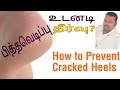 பித்தவெடிப்பு உடனடி நிவாரணம்|How To Prevent Cracked Heels|#Heelfissures #crackedheels #dryheels