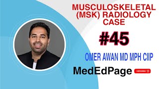 Musculoskeletal (MSK) Radiology CASE #45