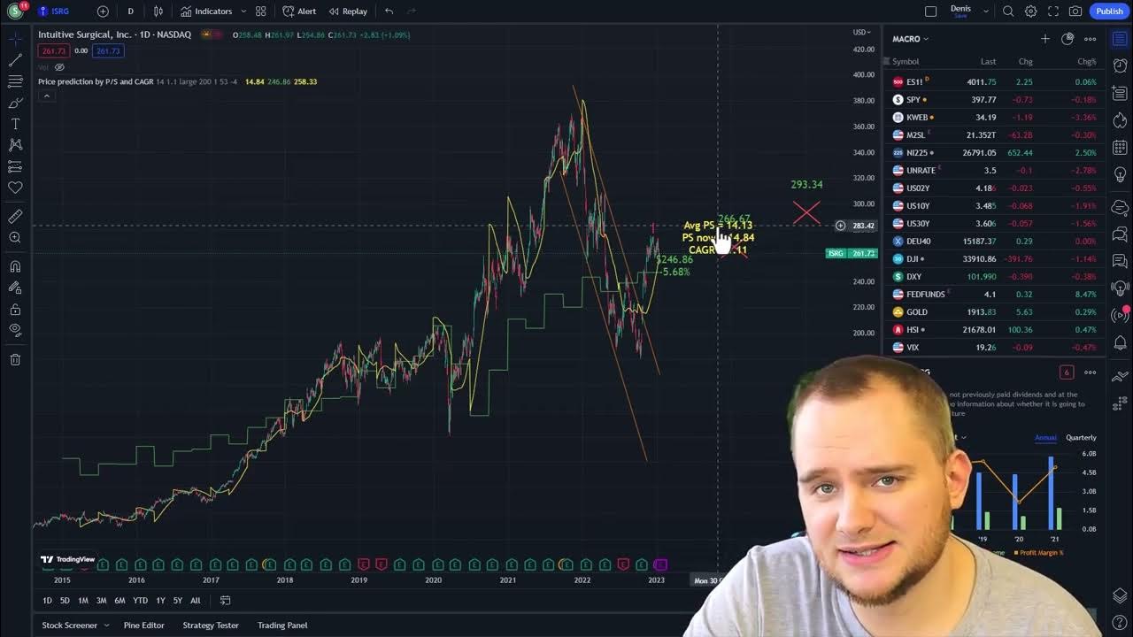 Intuitive Surgical stock price prediction 20242025 📈 (ISRG stock