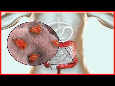 Vidéo: Quelle maladie est causée par un protozoaire ?