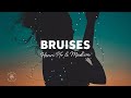Henri PFR & Madism - Bruises (Lyrics) ft. LONO