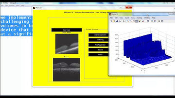 Mini Project on Matlab Program | Mini Thesis on Matlab Program