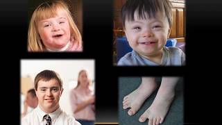 Lec 5 CIRI-CIRI MURID BERKEPERLUAN KHAS