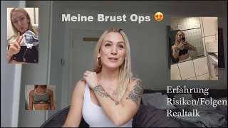 BRUST OP😱Intime Details😉 Vorher Nachher👭🤫Jenny König