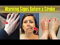 Before a Stroke: Here’s what happens if you Ignore These Warning Signs Before a Stroke!