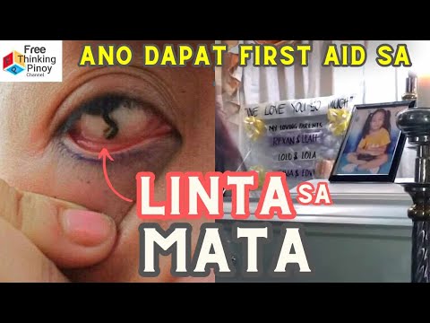 Baka Mangyari Sa'yo ITO! | Maliit na HAYOP pero Mapanganib