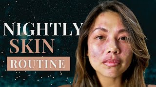 Birthmarked Skin Essentials: My Nightly Skin Care Routine!